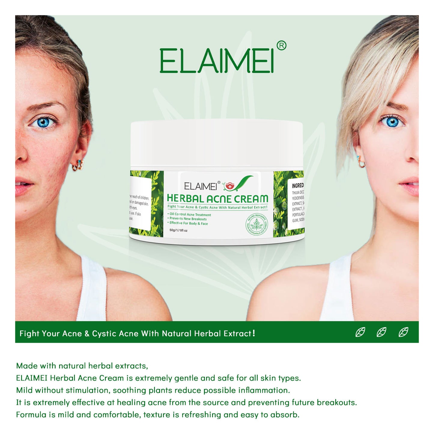Organic Herbal Extract Anti Acne Treatment Face Cream Remove Pimple Moisturizing Whitening Skin Care Facial Cream