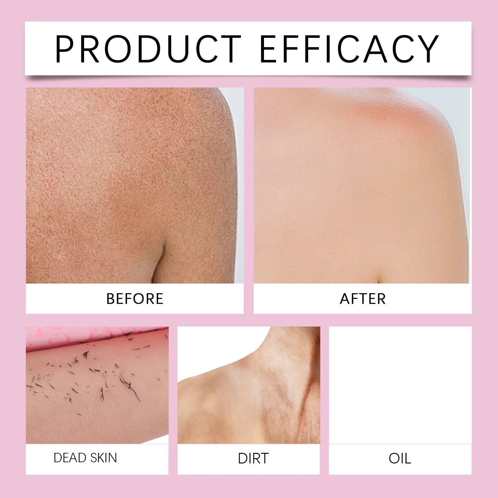 Exfoliating Back Scrubber Bath Gloves, Exfoliating Shower Towel for Body Scrub, Back Cleaner Wash Gloves to Remove Dead Skin (Pink)