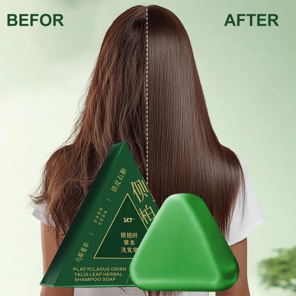 Shampoo Bar Platycladus Orientalis Natural Herbal Soap For Hair Loss Controls Oil Strengthens Root Shampoo Soap Hair Accessories