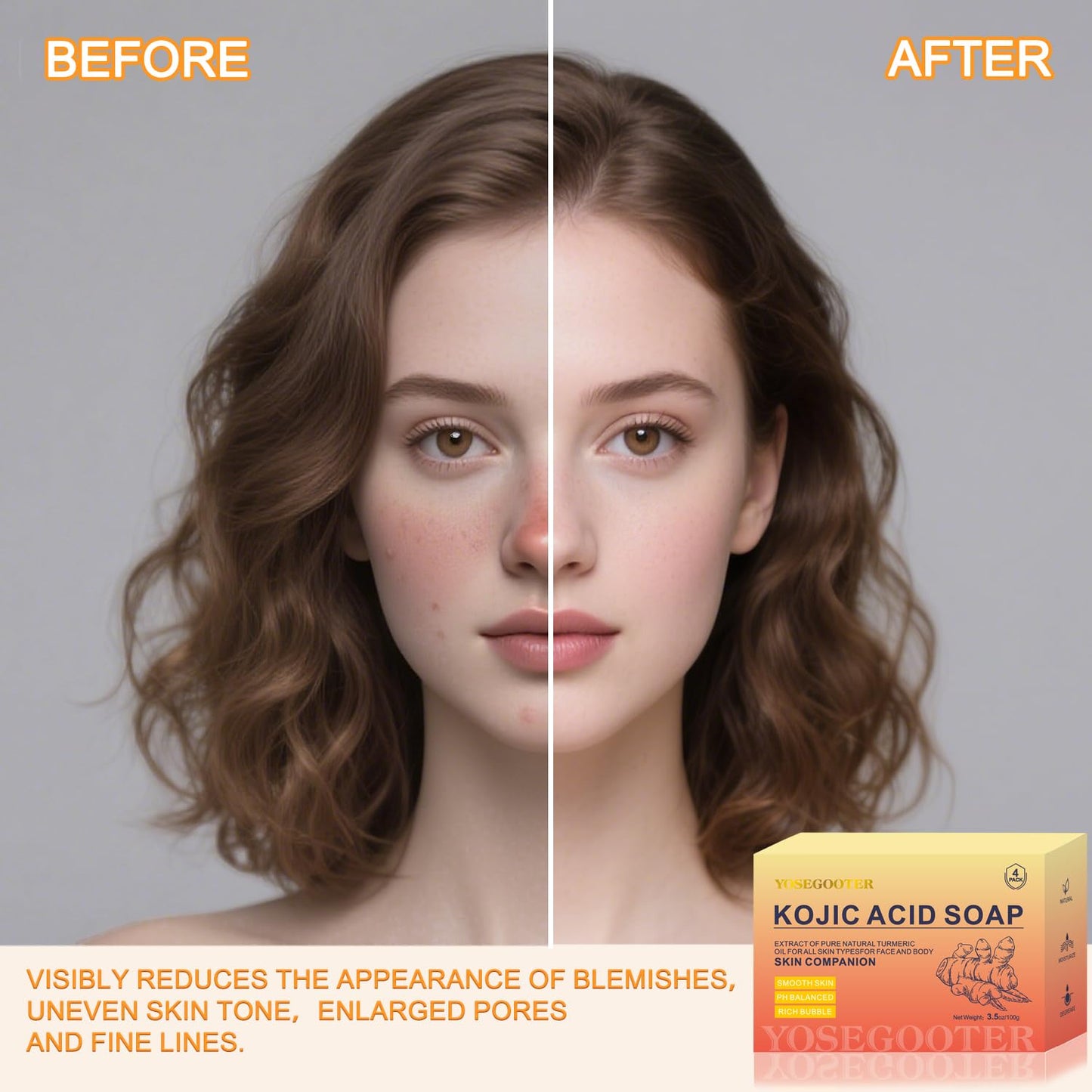 Turmeric Kojic Acid Soap Bars, Face&Body Dark Spots Remover, Turmeric Soap Bar for Dark Spots Brightening & Moisturizing with Collagen, Vitamin E, Retinol, Hyaluronic Acid, Shea Butter 1 Bar