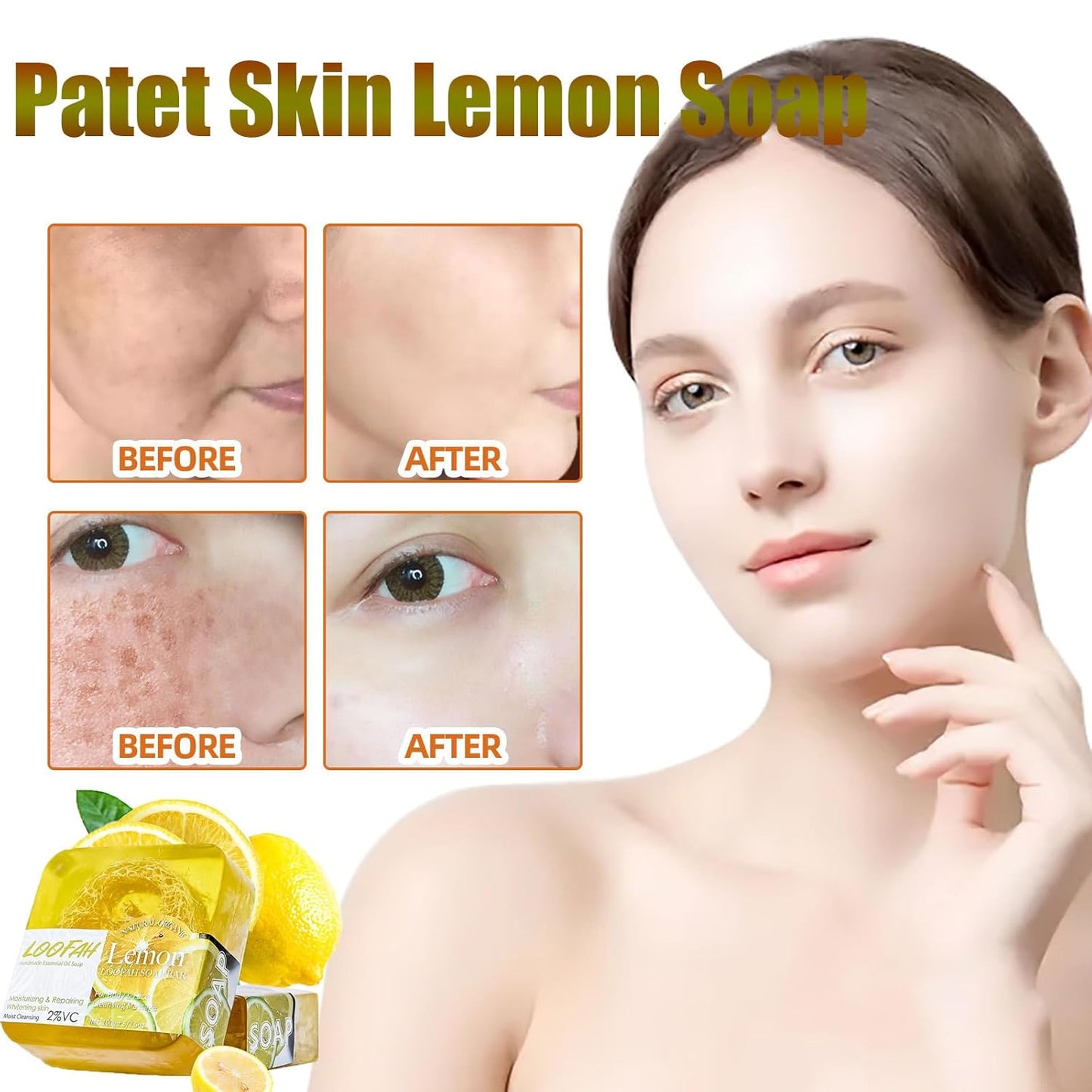 Patet Skin , Patetskin Bright & Even Lemon Bar, Patet Skin Essential Oil Bars, Patet Skin Bar, Patet Skin Care Lemon Acid for Hyperpigmentation, Dark Spots (Aloe)