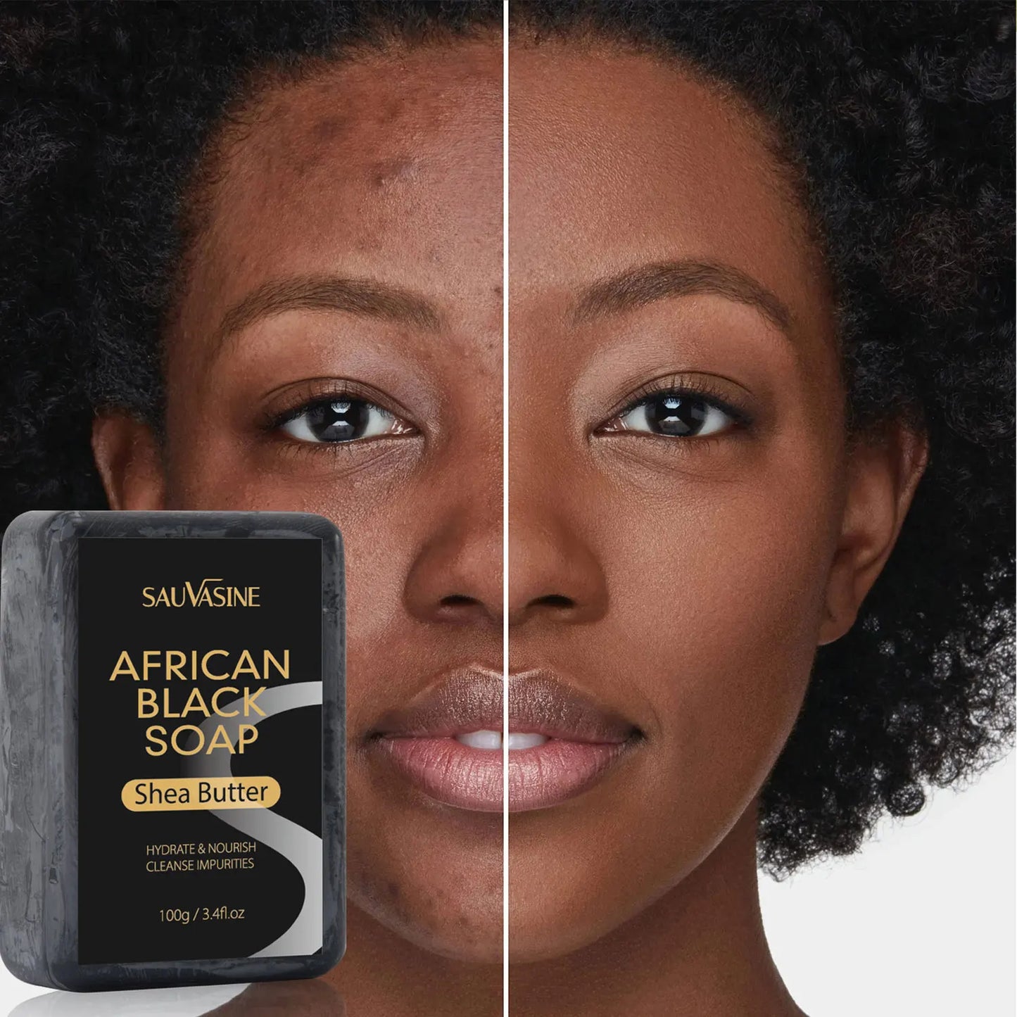100g AFRICAN BLACK SOAP Shea Butter Bar Moisturizing Acne Treatment Cleanser for Clear Skin Care Deep Cleaning Glowing