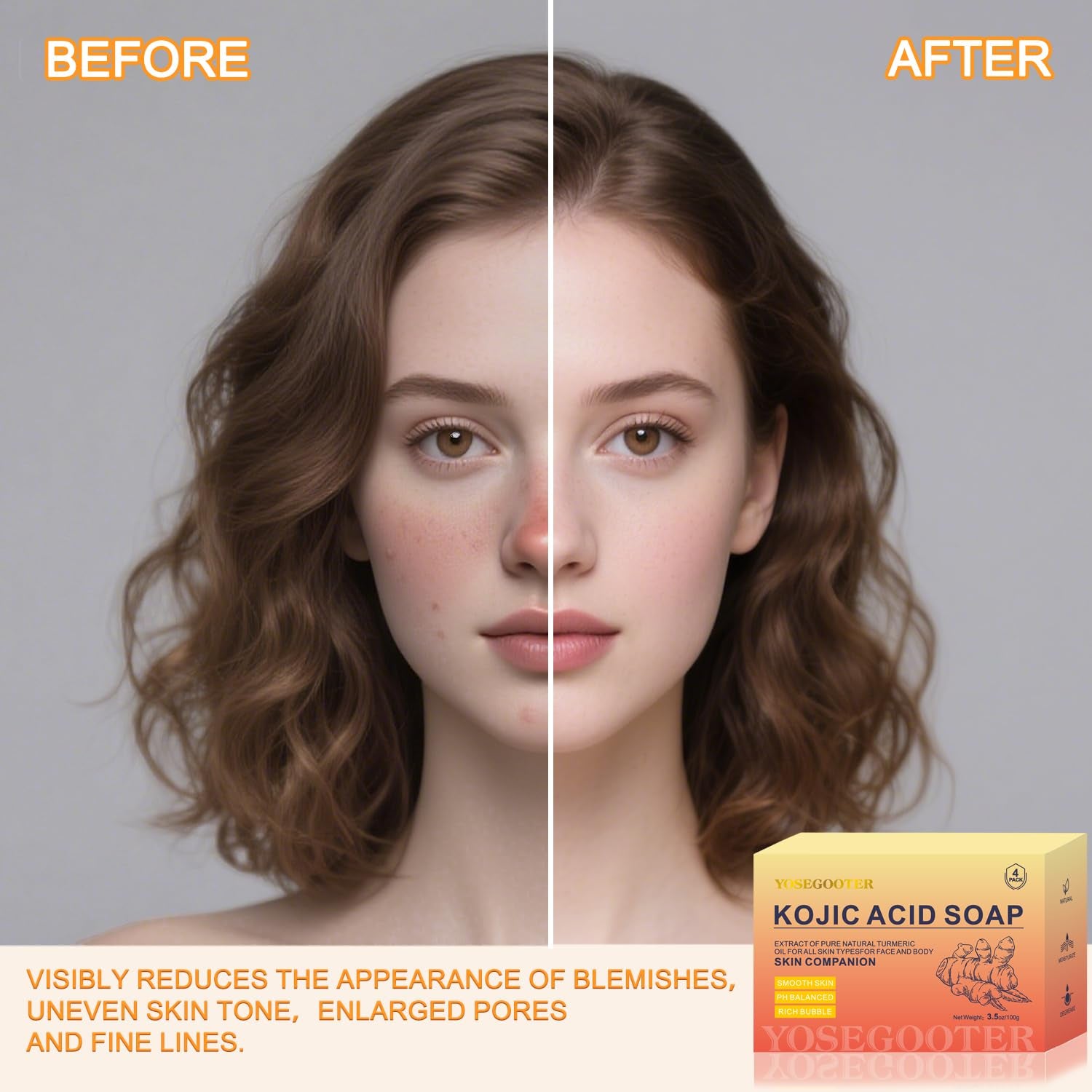 Turmeric Kojic Acid Soap Bars, Face&Body Dark Spots Remover, Turmeric Soap Bar for Dark Spots Brightening & Moisturizing with Collagen, Vitamin E, Retinol, Hyaluronic Acid, Shea Butter 1 Bar